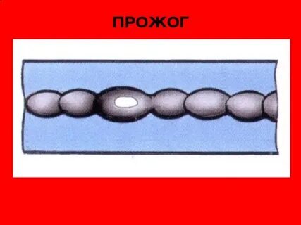Прожог