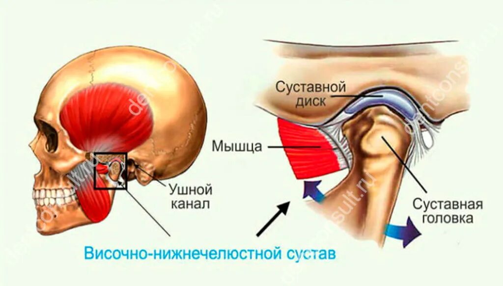 Внчс уха. Анатомия суставной головки ВНЧС. Височно-нижнечелюстной сустав анатомия дисфункция. Височно-нижнечелюстной сустав сустав анатомия строение.