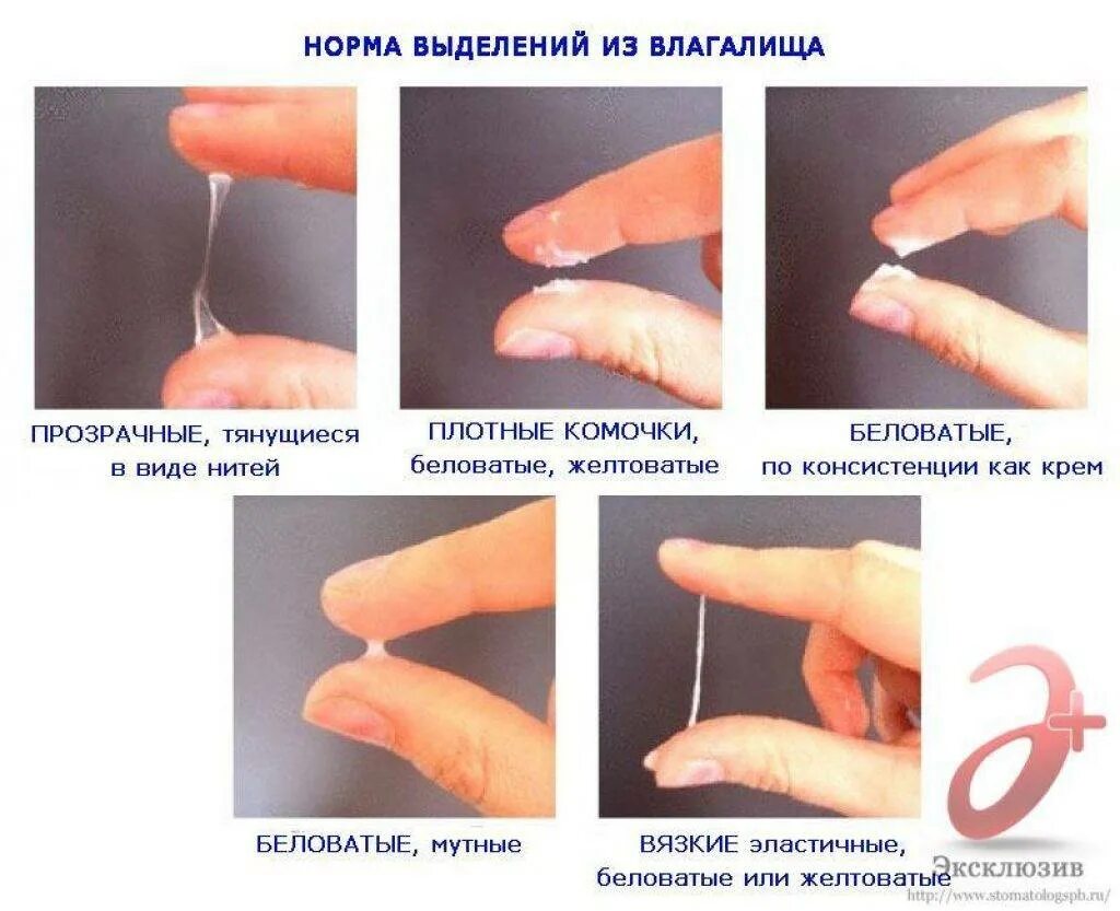 Почему нет выделений перед месячными