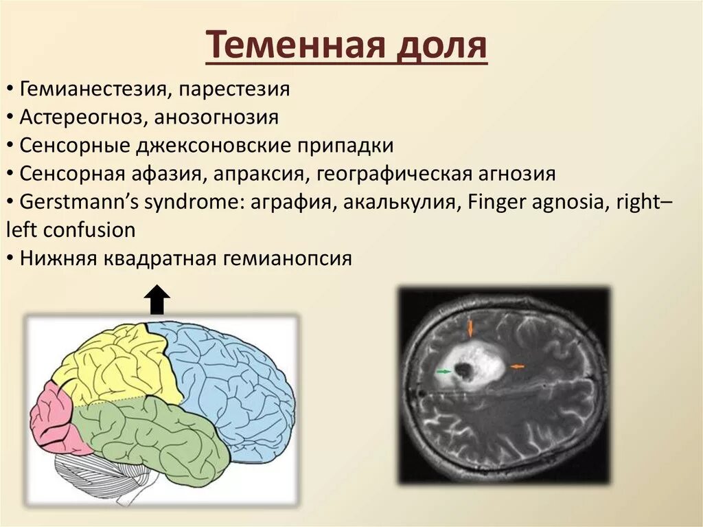 Функции теменной доли головного мозга.