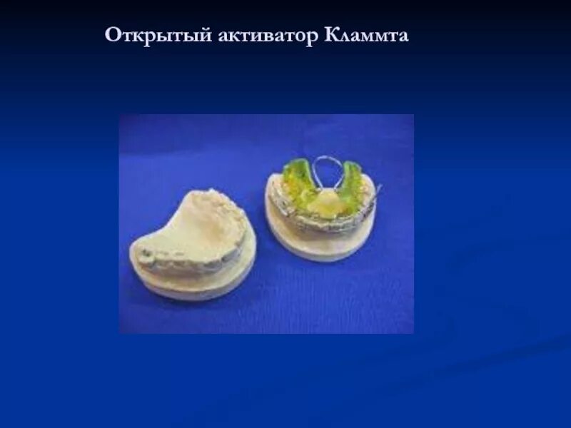 Открытый активатор кламмта 3 типа. Бионатор бальтерса 1 типа. Активатор кламмта ортодонтия. Открытый активатор кламмта ортодонтия. Активатор кламмта ортодонтия.