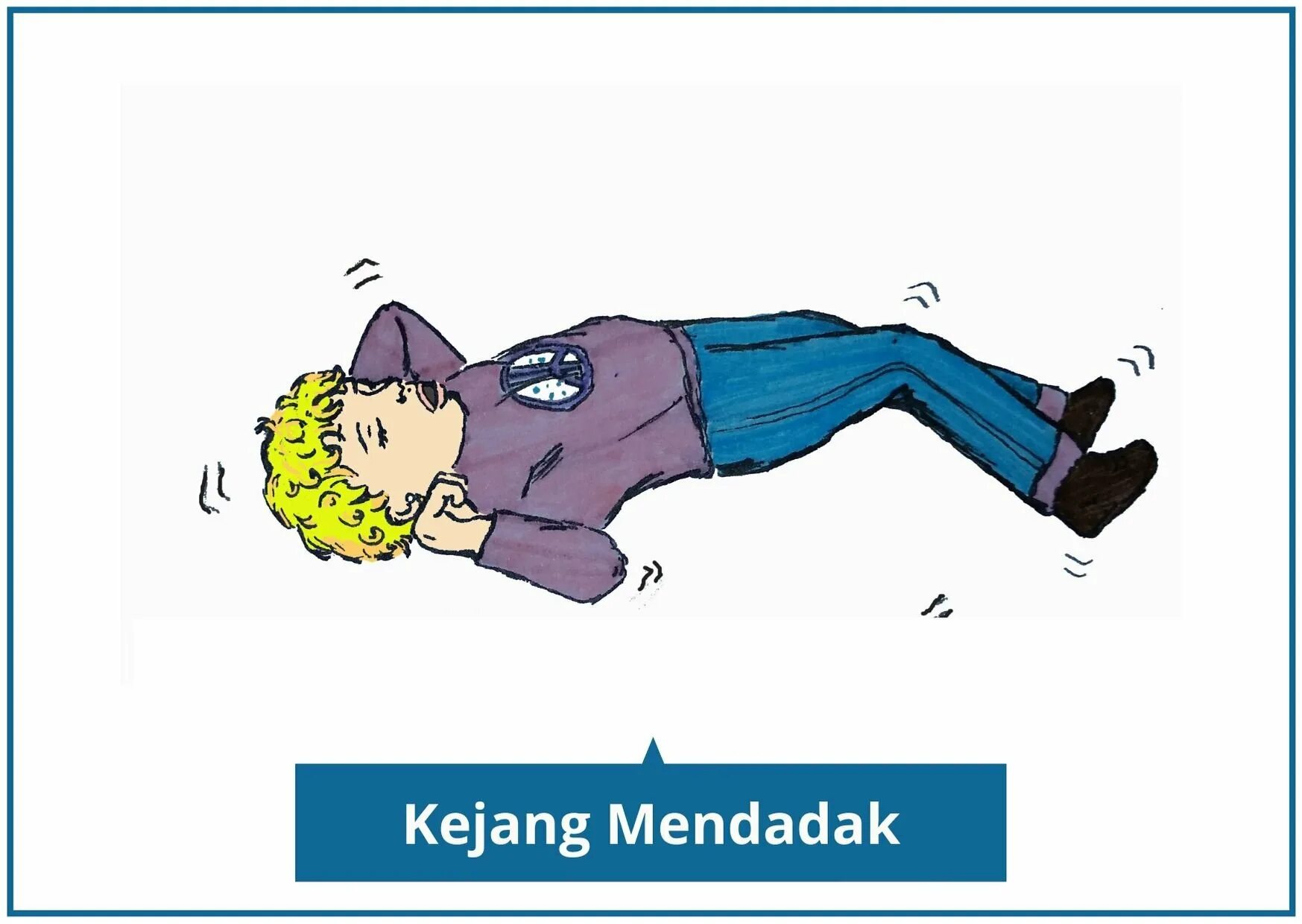 Роландическая эпилепсия симптомы. Характеристика клинической базы. Роландические комплексы на ээг. Роландическая эпилепсия у детей. Парциальные эпилептические приступы.