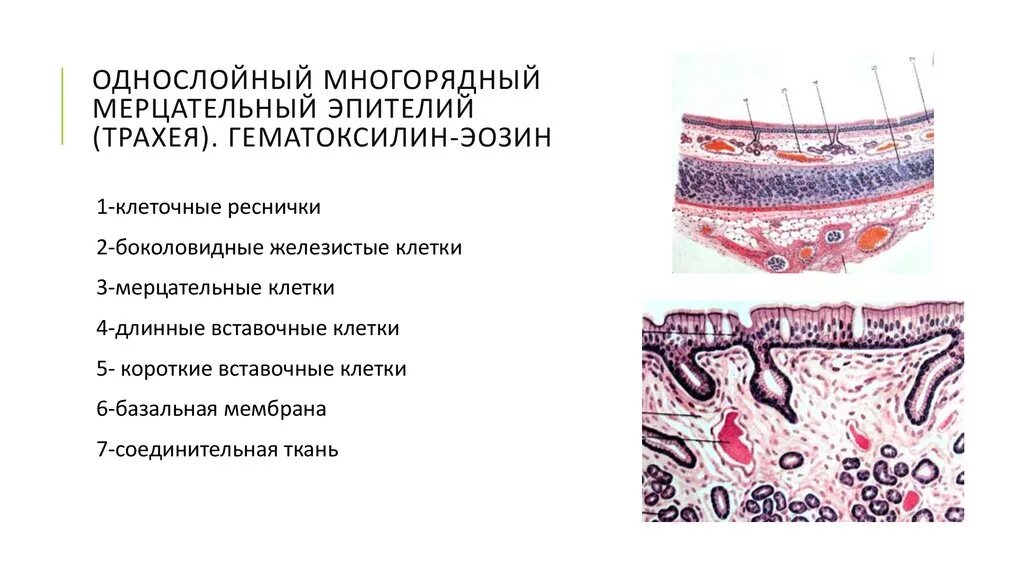 Эпителий выстилающий трахею. Эпителий выстилающий трахею