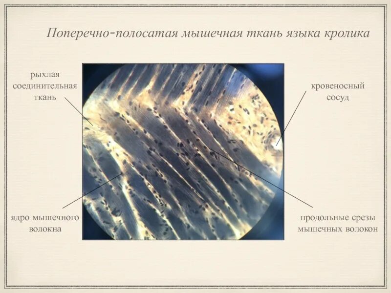 Поперечно полосатая мышечная ткань языка кролика. Поперечно полосатая мышечная ткань ящыкакролика. Поперечно полосатая ткань языка кролика. Поперечно-полосатая мышечная ткань языка препарат. Препарат поперечно полосатая мышечная ткань