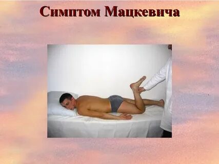 Симптом вассермана