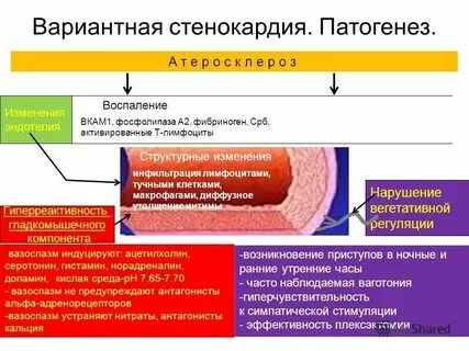Патогенез стенокардии напряжения