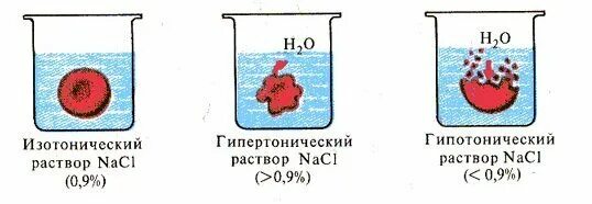 Изотонический гипертонический и гипотонический растворы. Эритроцит в гипотоническом и гипертоническом растворе. Плазмолиз гипертонический раствор. Гипотонический и гипертонический растворы концентрация. Клетки находятся в дистиллированной воде