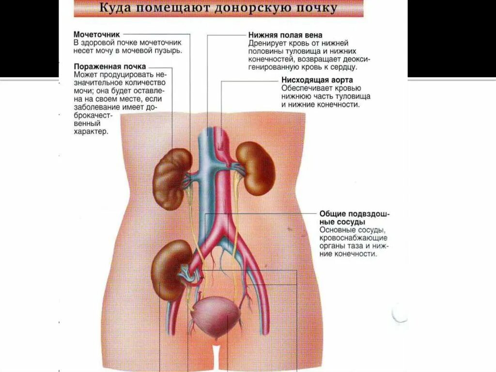Почка человека донор. Почка человека донор. Почка человека донор. Почки рисунок. Почка человека донор.
