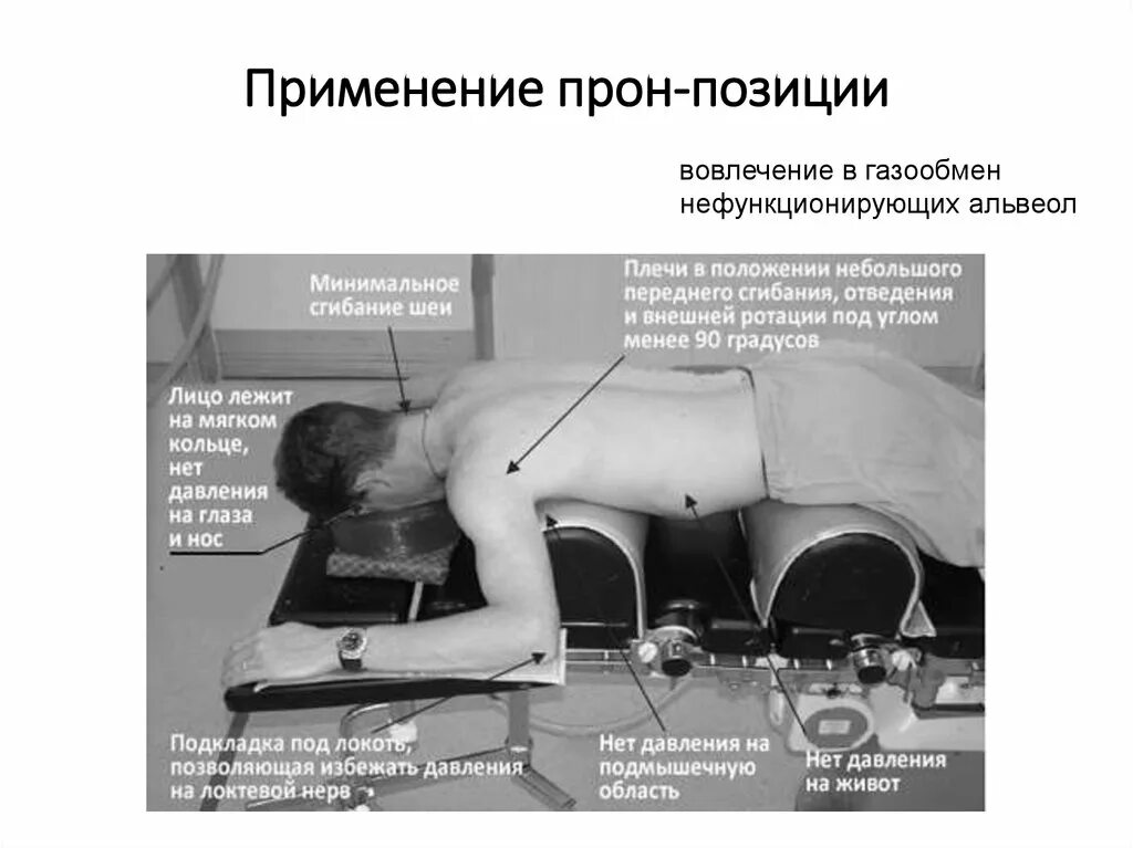 почему нельзя лежать при пневмонии. правильная поза для сна. поза для сна при пневмонии. почему нельзя лежать при пневмонии. положение пациента на животе.