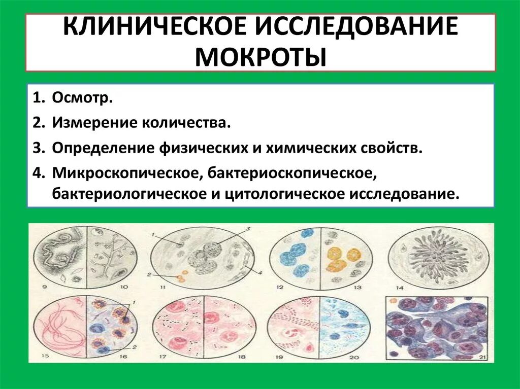 Исследование мокроты микроскопия норма. Общеклиническое исследование мокроты. Химическое исследование мокроты. Методы исследования мокроты.