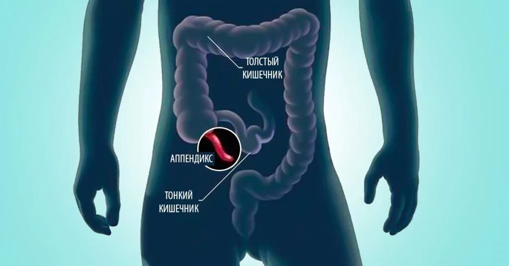 Боли внизу кишечника у мужчин. Где находится аппендикс. Где находитсяаапендикс. Фото аппендикса расположение.