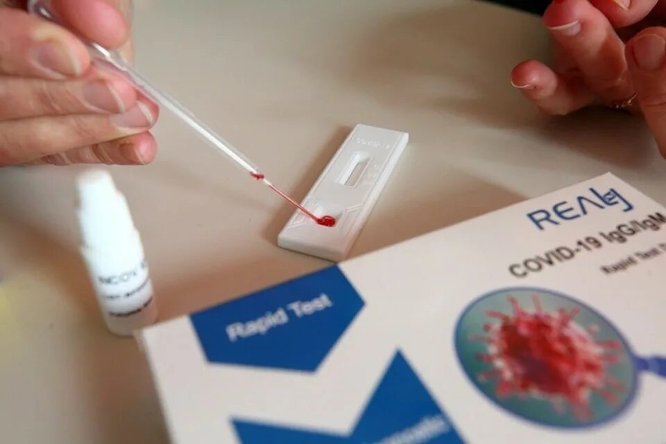 Тест на коронавирус по тесту. Экспресс тест на коронавирус кровь. Тест на антитела кровь из пальца. Тест на коронавирус по крови из пальца. Экспресс тест на ковид кровь из пальца.