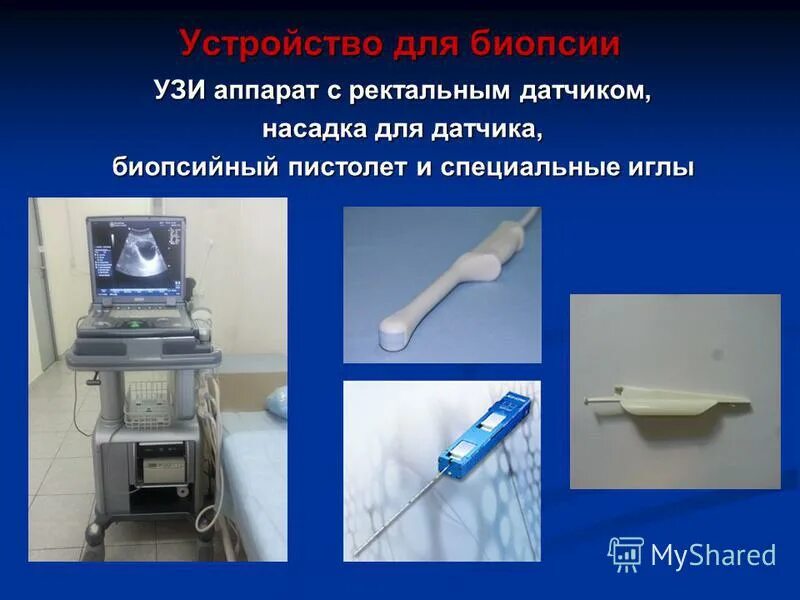 ректальное узи подготовка. трансректальное узи предстательной. датчик узи для предстательной железы. узи трузи предстательной железы. узи предстательной железы ректальным датчиком что это.