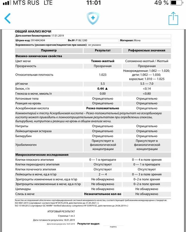 Белок в моче 0.368. Белок в моче 32 г/л. Белок в моче показатели нормы у женщин. Белок в моче норма г/л. Белок 0 13