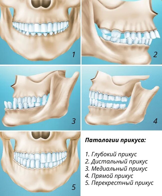 Зубы при закрытом рте