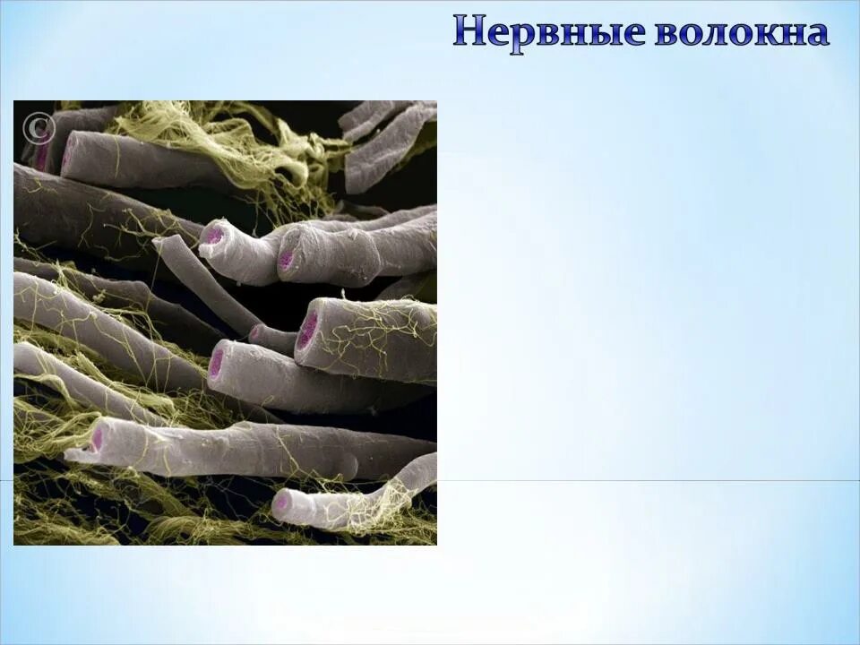 Безмиелиновое нервное волокно гистология. Отростки нейронов, покрытые оболочками называются нервными. Нервные волокна. Нервные волокна отростки. Перехват ранвье в нервном волокне.