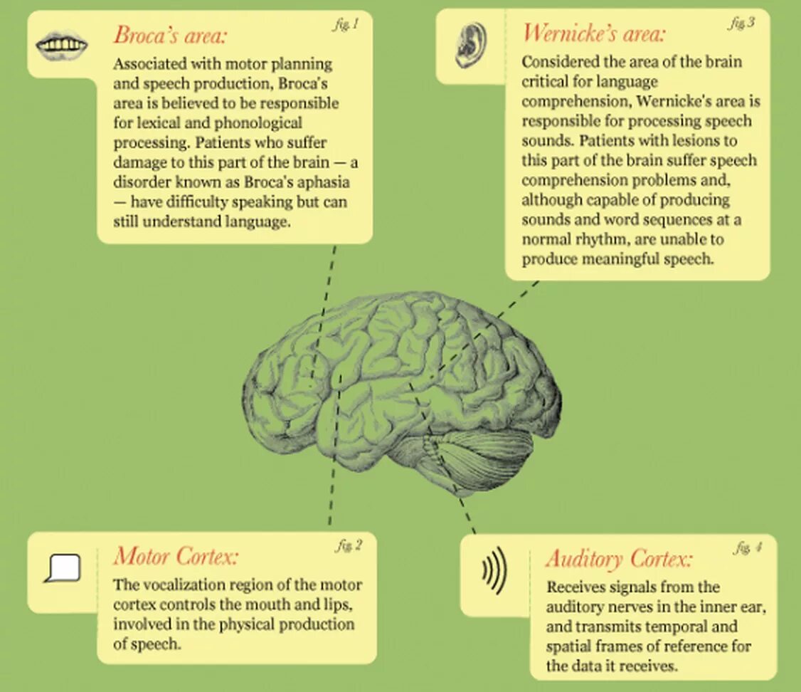 Language and the brain. Speech comprehension. language and speech. мозг и речь. speech disorders.