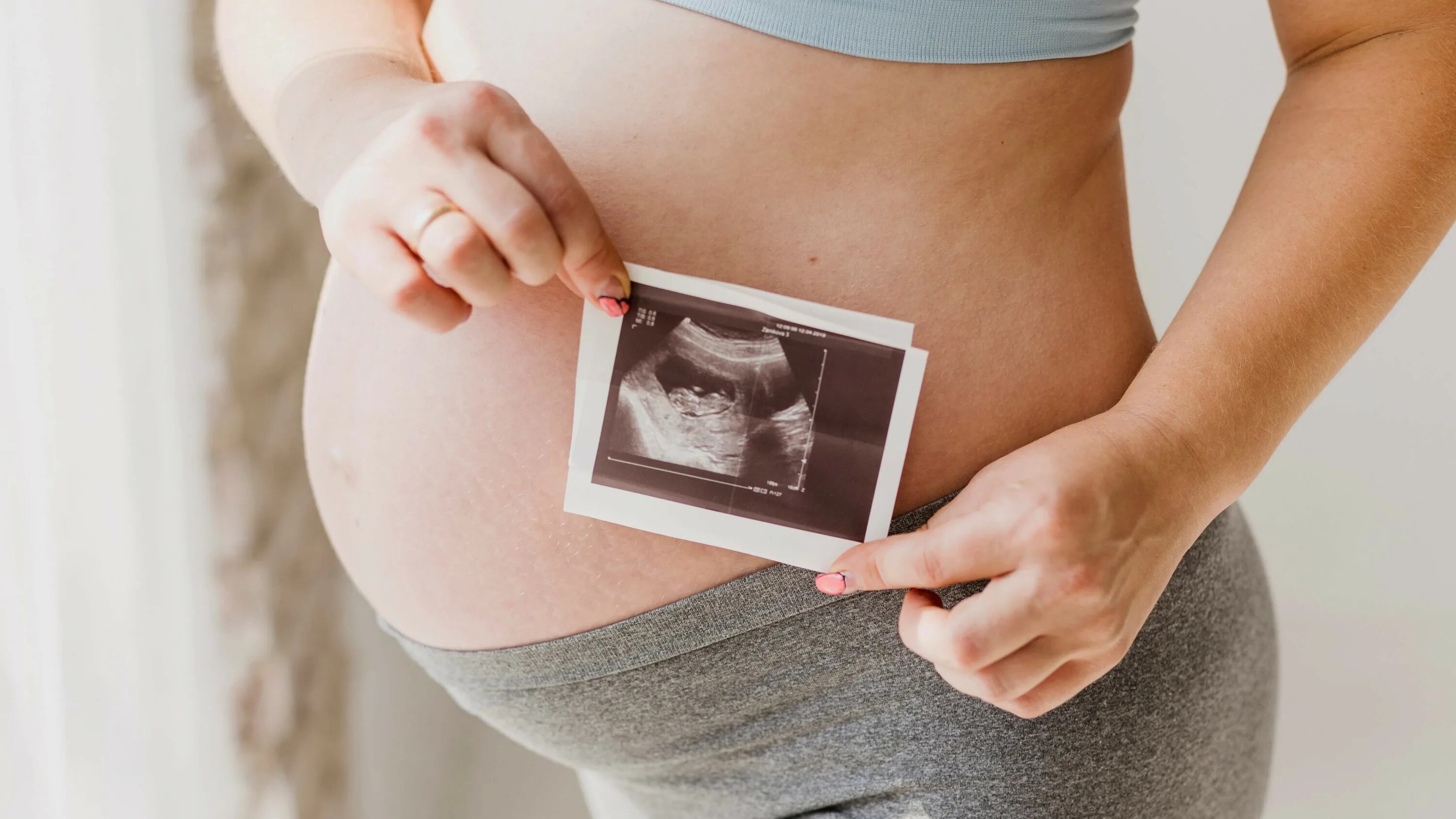 Женщины беременные двойней. Многоплодная беременность эко. Беременность двойней после эко. Беременность двойня эко. Двойняшки и тройняшки после эко.