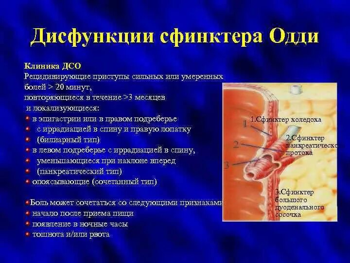 Воспаление сфинктера Одди. Дисфункция сфинктера Одди клиника. Сфинктер Одди дисфункция симптомы. Почему сфинктер