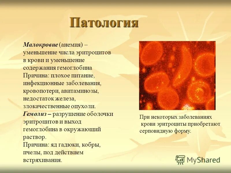 При каком заболевании эритроцитов. Гемолиз эритроцитов в крови. Причины повышения и понижения эритроцитов. Причины пониженных эритроцитов. Снижение эритроцитов причины.