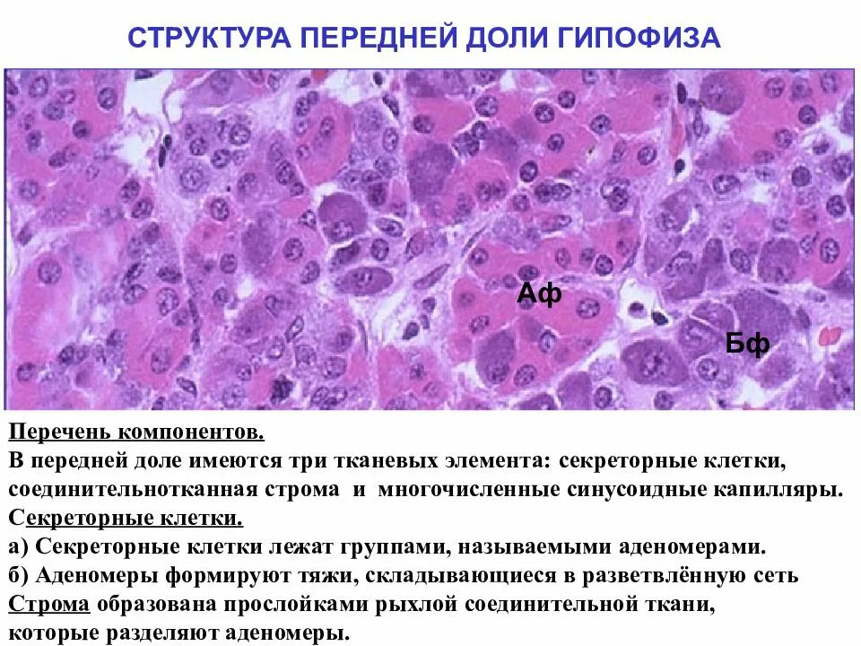 Гипофиз ткань. Клетки передней доли гипофиза гистология. Хромофобная аденома гипофиза гистология.