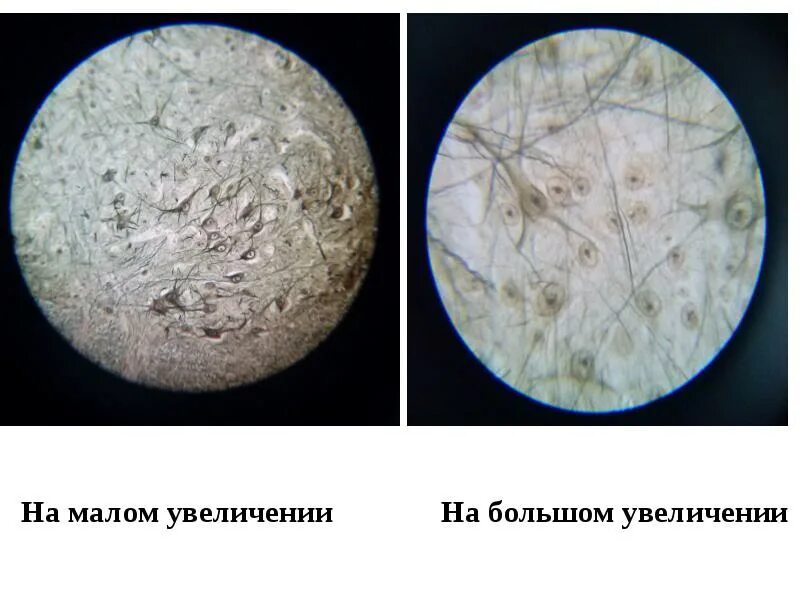 Увеличение больших половых. Корона Радиата гистология на Малом и большом оптическом увеличении. Увеличение. Большой увеличенный малый увеличенный. Перекрест волос под микроскопом рисунок.