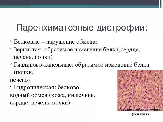 Паренхиматозные белковые дистрофии гиалиново капельная. Паренхиматозная белковая зернистая дистрофия. Паренхиматозные белковые дистрофии таблица зернистая. Классификация паренхиматозных белковых дистрофий.