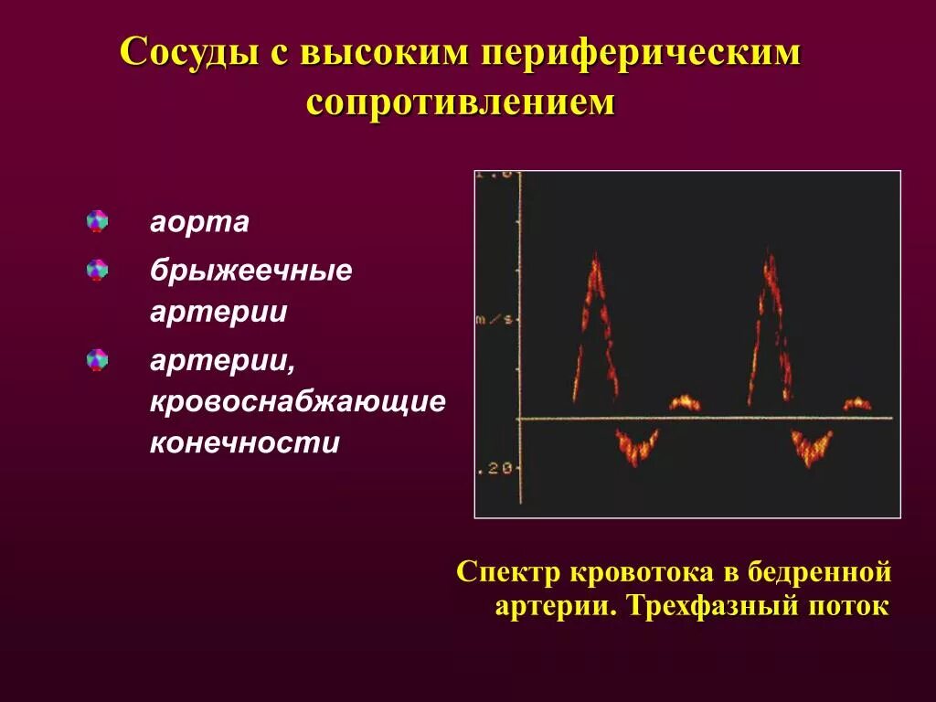 Сосуды с высоким периферическим сопротивлением. Спектр кровотока. Артерии с высоким и низким периферическим сопротивлением. Артерии с низким периферическим сопротивлением это. Индекс резистентности артерий