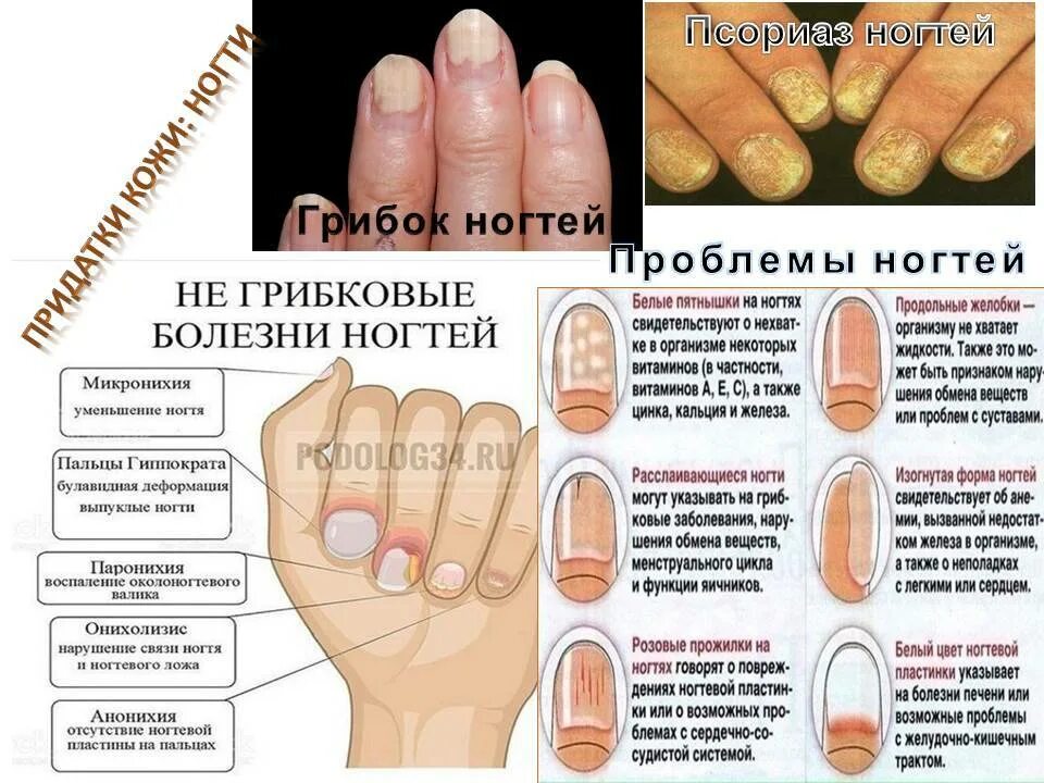 Как отличить болезнь. Распространенные заболевания ногтей.