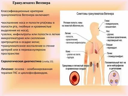 Гранулематоз это
