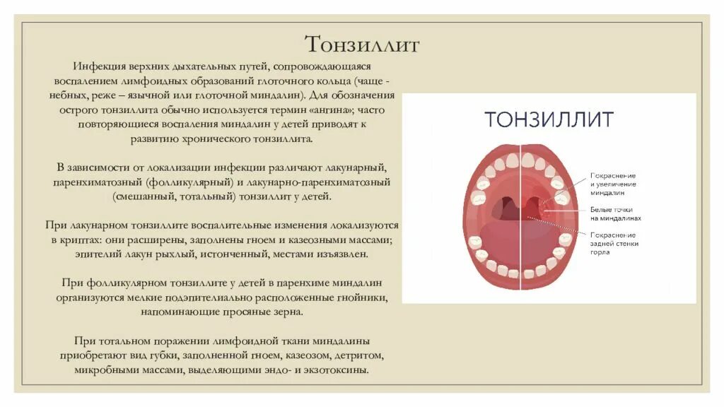 Тонзиллит у ребенка 5 лет симптомы. Воспаление миндалин психосоматика. Лечим горло при беременности 3