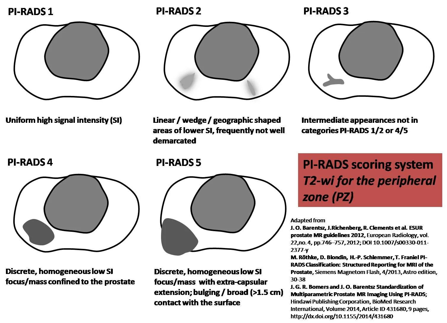 Pi rads 5. Pirads 3 предстательной железы. Зоны предстательной железы на УЗИ. Предстательная железа кт анатомия. Анатомия предстательной железы на УЗИ.