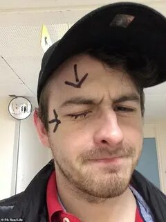 Nick eye