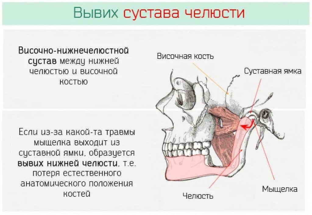 Болят зубы с правой стороны. Почему болит челюсть снизу. Болит сбоку нижней челюсти. Мышцы и связки височно-нижнечелюстного сустава. ВНЧС костные структуры.