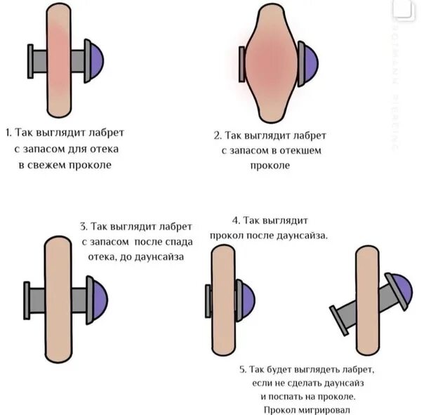 Даунсайз это. Даунсайз это. Даунсайз схема. Даунсайз схема. Даунсайз это.