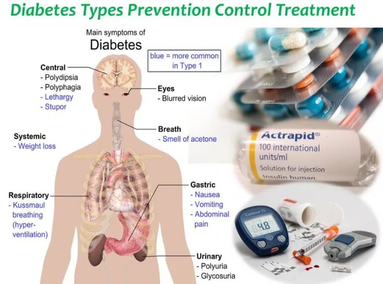 Prevention of Diabetes. Diabetes Types. Diabetes mellitus. Diabetes Symptoms. Second main