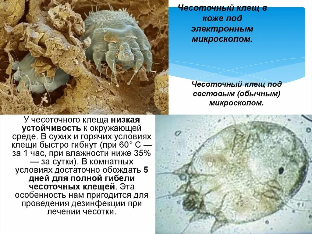 Сколько живет чесоточный. Чесоточный зудень (Sarcoptes scabiei). Чесоточный клещ под микроскопом на коже. Клещ Sarcoptes scabiei возбудитель чесотки.