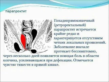 Прямая кишка боли симптомы