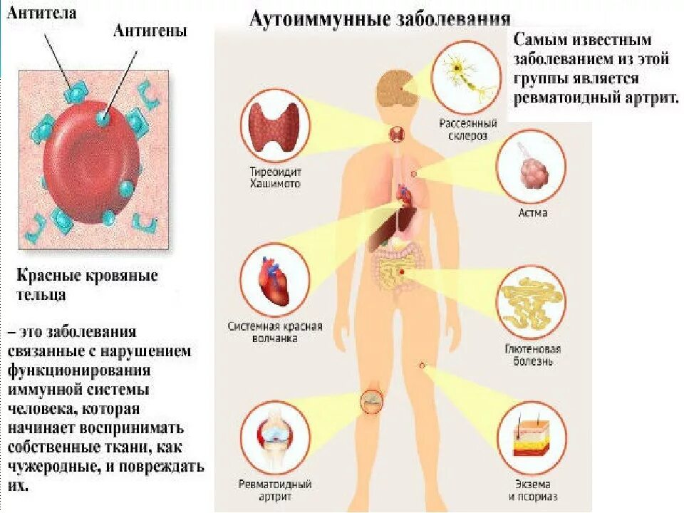 Аутоиммунные заболевания. Fentbveyyjtpf,jktdfybt. Болезнь аутоиммунной системы. Аутоиммунные заболевания что это такое у человека. Аутоиммунных осложнений