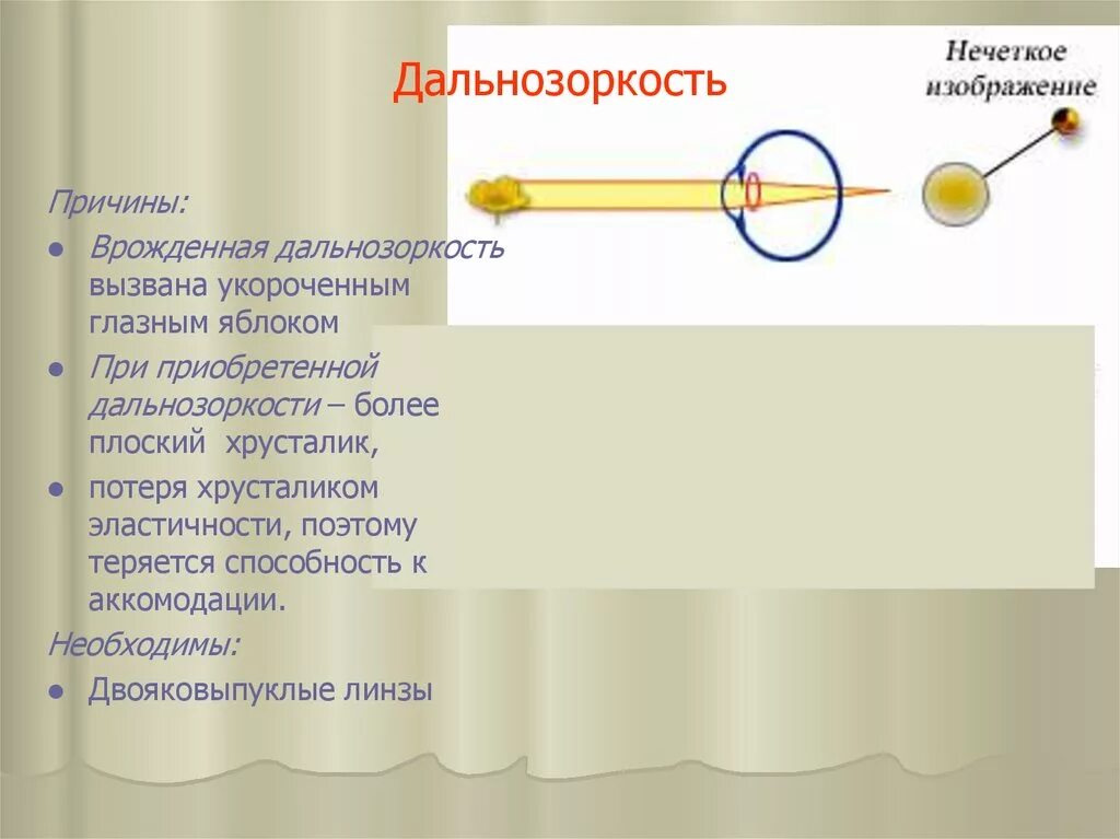 Причины возникновения дальнозоркости. Причины дальнозоркости. Причина врожденной дальнозоркости. Гиперметропия причины возникновения.