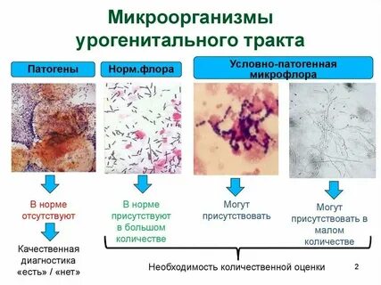 Условно патогенные анаэробные микроорганизмы у мужчин