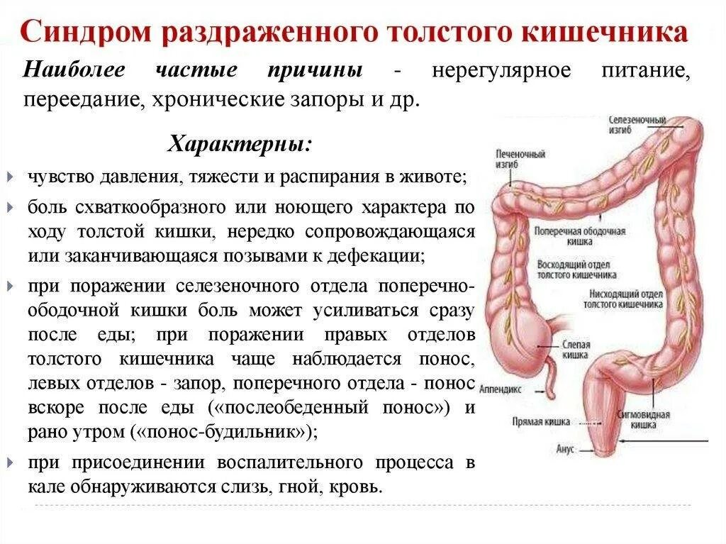 Синдром раздраженного кишечника толстой кишки симптомы. Синдром раздраженной кишки. Синдром раздражённо го кишечника. Синдом раздражённо Юго кишечникп