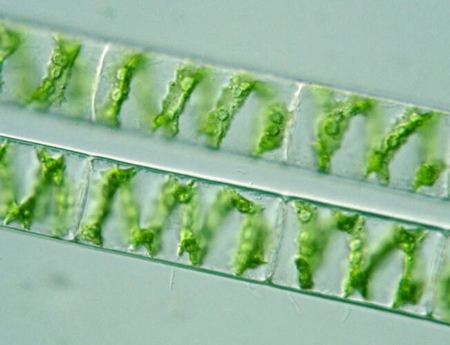 Спирогира однодольное или. Spirogyra. зеленые водоросли спирогира. spirogyra sp. спирогира в микроскопе.