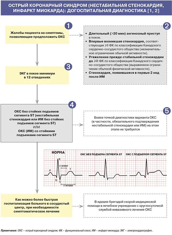 Диагноз нестабильная стенокардия. Нестабильная стенокардия ЭКГ. Окс с описанием ЭКГ. Синдром нестабильной стенокардии ЭКГ. Окс с подъёмом St ЭКГ.