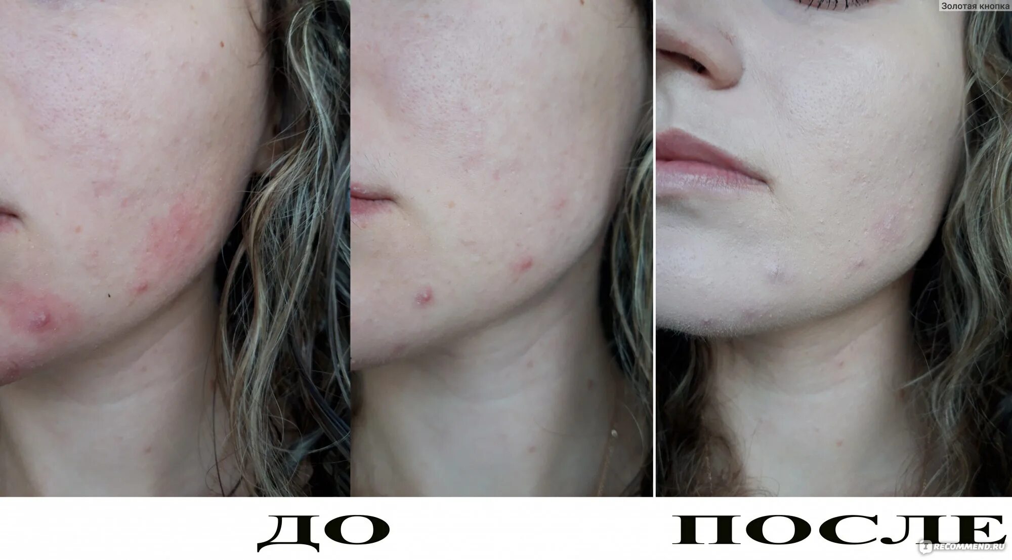 Luxvisage soft matte blur effect. Тональный крем skin evolution. тональный крем люкс визаж skin evolution. luxvisage skin evolution soft matte blur effect свотчи. skin evolution soft matte.