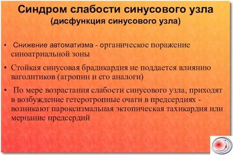 Вегетативная дисфункция синусового узла