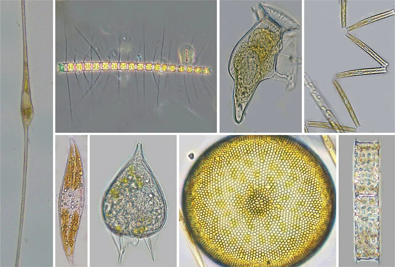 Фитопланктон водоросли. Фитопланктон диатомовые водоросли. Phalacroma rotundatum фитопланктон. Фитопланктон электромикроскопия. Пресноводный фитопланктон.