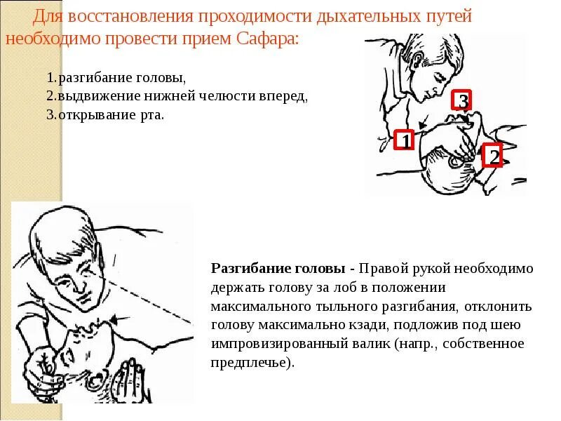 Какой метод поддержания проходимости дыхательных. Обеспечение проходимости дыхательных путей. методы восстановления проходимости дыхательных путей. обеспечение проходимости дыхательных путей у детей до года. приемы восстановления проходимости дыхательных путей у детей.