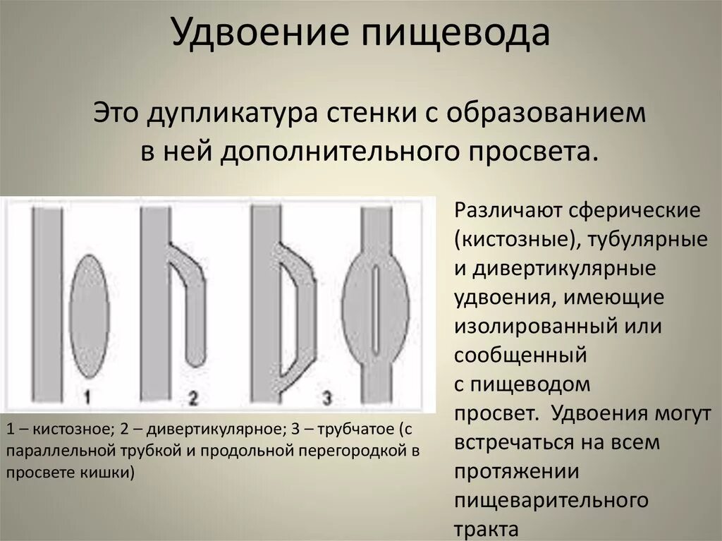 Формирование пищевода. Пороки развития пищевода. Врожденная патология пищевода. Кистозное удвоение пищевода.