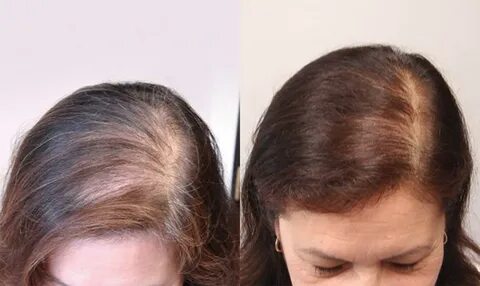 Rixon hair